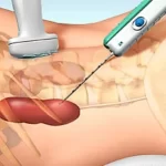 What is Kidney Biopsy – Indications/ pros and cons